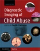 Diagnostic_imaging_of_child_abuse